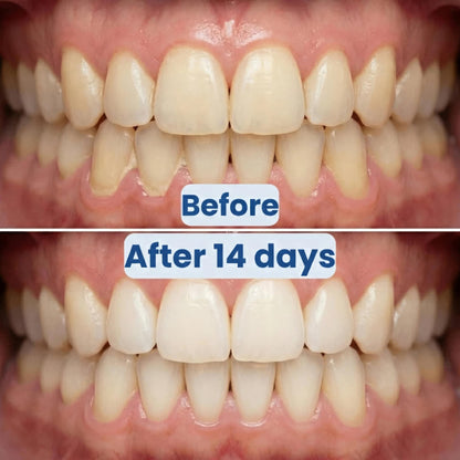 360° Rolling Floss Toothbrush